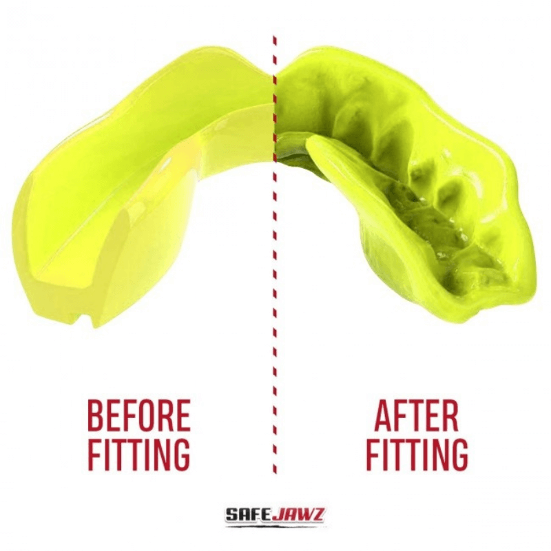 Voor en na afbeelding van een neon gele SafeJawz mondbeschermer, die de aanpassing aan de vorm van de tanden illustreert