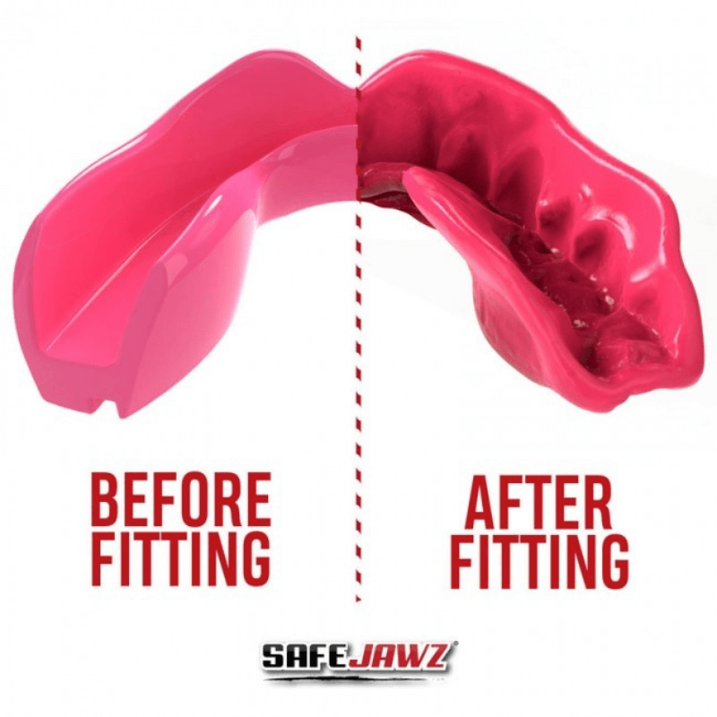 Een voor-en-na afbeelding van een roze SafeJawz mondbeschermer die het aanpassingsproces illustreert, met de tekst 'BEFORE FITTING' en 'AFTER FITTING'.