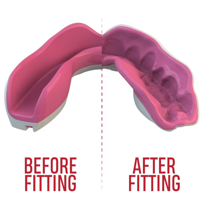 Demonstratie van het aanpassen van een roze SafeJawz mondbeschermer, voor en na het proces voor een perfecte pasvorm.