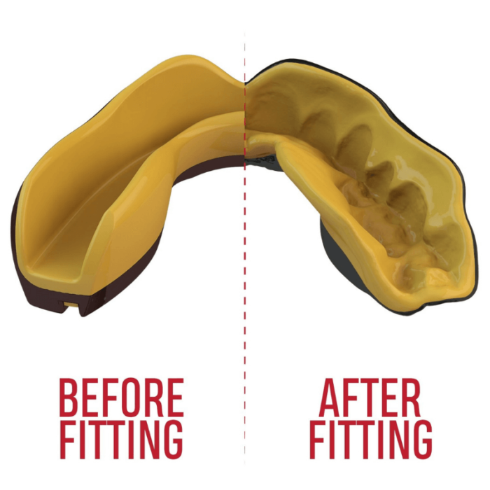 Grafische weergave van de fitting van een gele SafeJawz mondbeschermer, voor en na het passen.