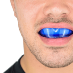 Man draagt een doorzichtige blauwe SafeJawz mondbeschermer, zichtbaar comfortabel en nauwsluitend.