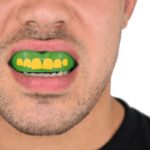 Persoon die een felgroene mondbeschermer draagt met gele tanden ontwerp, opvallend en sportief.
