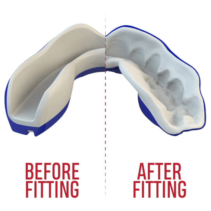 Grafische weergave van een mondbeschermer voor en na het vormen, met de ongevormde versie in grijs en de gevormde versie conform aan tanden.